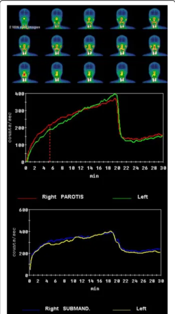 Fig. 1 Salivary gland scintigraphy
