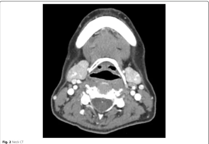 Fig. 2 Neck CT