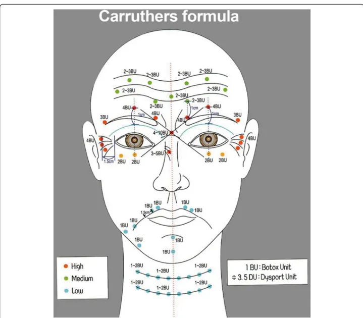 Fig. 3 A protocol used for forehead creases and eye wrinkles. The standard dose was determined based on BTXA