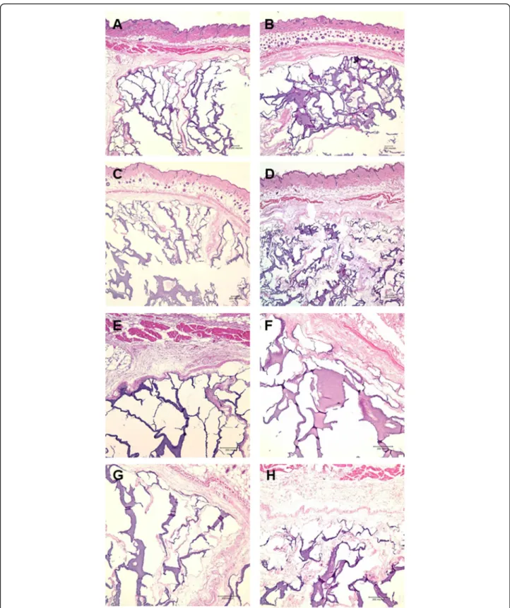 Fig. 2 Microscopic view of the hydrogel groups stained with HE. a, e The hydrogel only group showed the active infiltration of cells and the ingrowth of host tissue into the hydrogel (HE; original magnification, × 40, × 100)