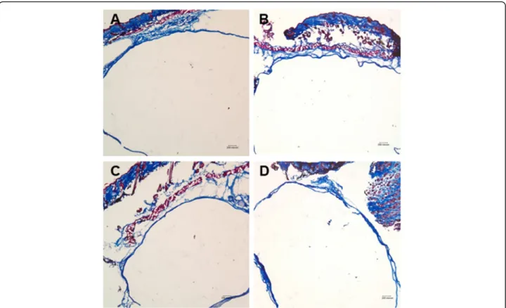 Fig. 6 Soft tissue histomorphometry of the hydrogel groups. The amount of newly formed soft tissue was significantly higher in the hydrogel combined with fibroblasts (HF) and hydrogel mixed with bFGF and fibroblasts (HBF) groups compared with that in the h
