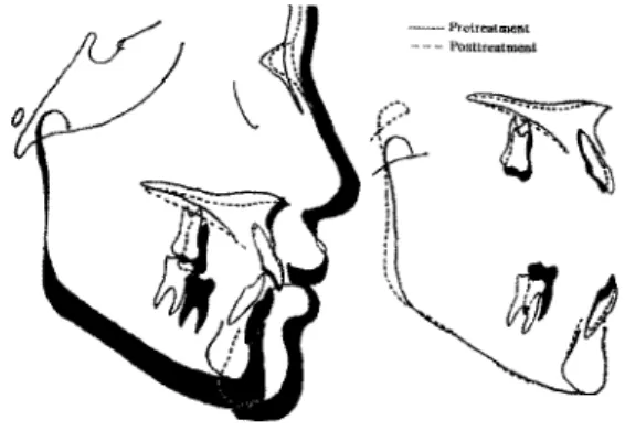 Fig.  5.  S uperim positi ᄋ n o f tita n iu m  microsGrew  impl­