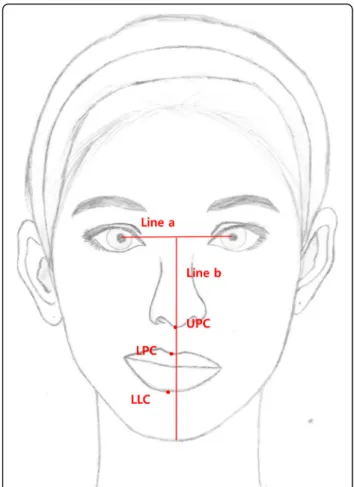 Fig. 2 Reference points and lines for measurement of the philtrum position deviation on a frontal view of a clinical photograph