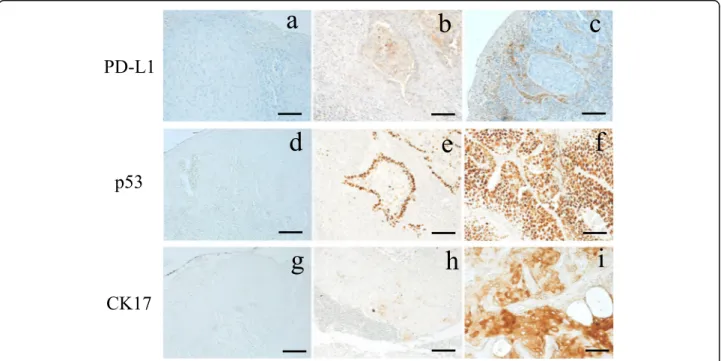 Fig. 1 Representative images of PD-L1, p53 and CK17 expression by IHC. a PD-L1 expression negative