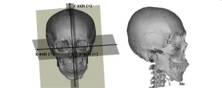 Fig. 1 Three-dimensional reference planes and craniofacial landmarks. Cr, crista galli; Cl, clinoid process; Op, opisthion; Po, porion; Me, menton; Go, gonion; Gf, glenoid fossa; Or, orbitale; Zy, zygonion