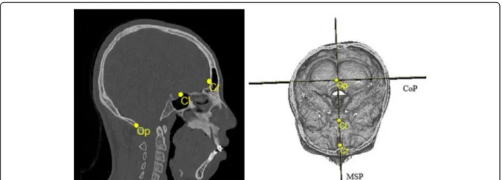 Table 1 Description of craniofacial landmarks and reference planes