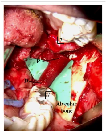 Table 2 Postoperative data of visual analog scale and another various assessments