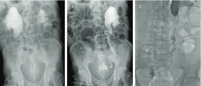 Fig. 5. Postoperative cystogram demonstrates 