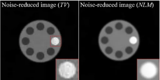 Fig. 4. Comparison result of the noise reduction image with TV algorithm (left) and that of NLM algorithm (right).
