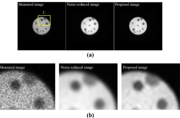 Fig. 3 shows the Monte Carlo simulation results of a (a) simu- simu-lated image (left top), noise-reduced image (top right), predicted blur image (bottom left), and proposed image (bottom right); and the (b) enlarged images of the simulated image (left),  