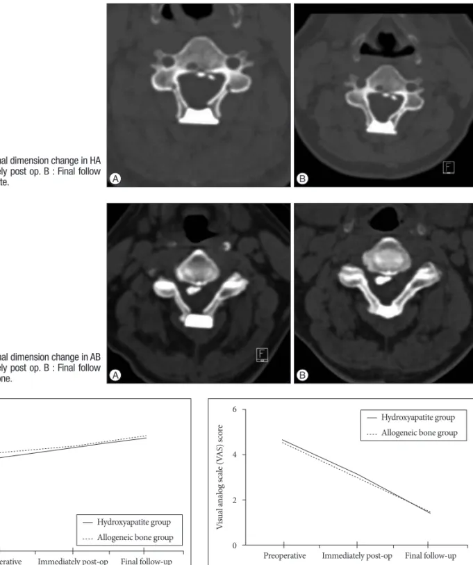 Fig. 4. The spinal canal dimension change in AB  group. A : Immediately post op. B : Final follow  up