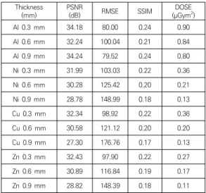 Table 3. DAP-based radiation dose comparison by filter  material Characteristic  Comparison N M ±SD** F p* FilterOne Al 300 0.845 ±0.147 1528.603 0.000Cu3000.268±0.149Zn900.238±0.094 Ni 300 0.274 ±0.152 Total 990 0.444 ±0.293 FilterTwo 1Al+Cu 270 0.259 ±0.