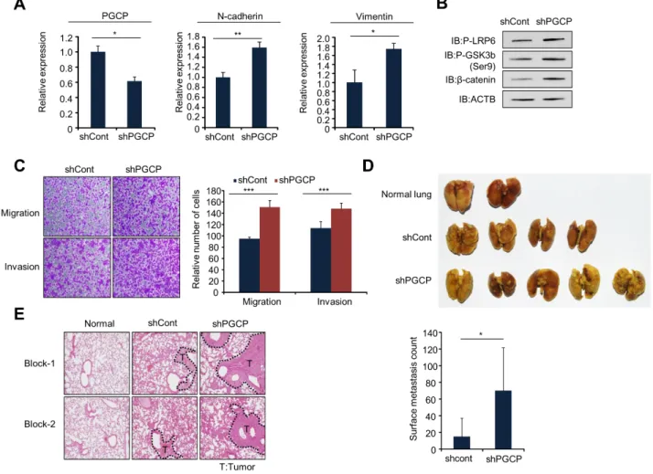 Figure 5: Knockdown of PGCP promotes lung metastasis in vivo.  A. Quantitative RT-PCR analysis of PGCP, N-cadherin and  vimentin cDNA was isolated from shCont and shPGCP stable cell lines