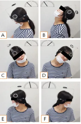 Fig.  3.  Measurement  of  The  cervical  Range  of  Of  Motion. (A: Flexion, B: Extension, C: Right Side Flexion, D: Left Side Flexion, E: Right Rotation, F:  Left  Rotation)