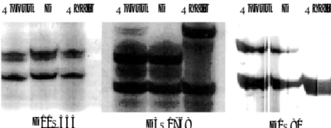 Fig. 6. DNA typing of patient with aplastic anemia, after 18 months of BMT. Selected informative markers were shown such as D11S554, D3S1768 and D1S80.