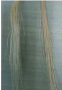 Fig.  1.  Sample  of  collected  hair