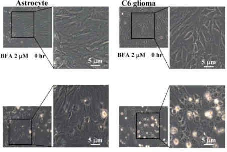 Fig.  1.  Effect  of  BFA  on  cell  morphology  of  astrocyte  and  C6  glioma  cells