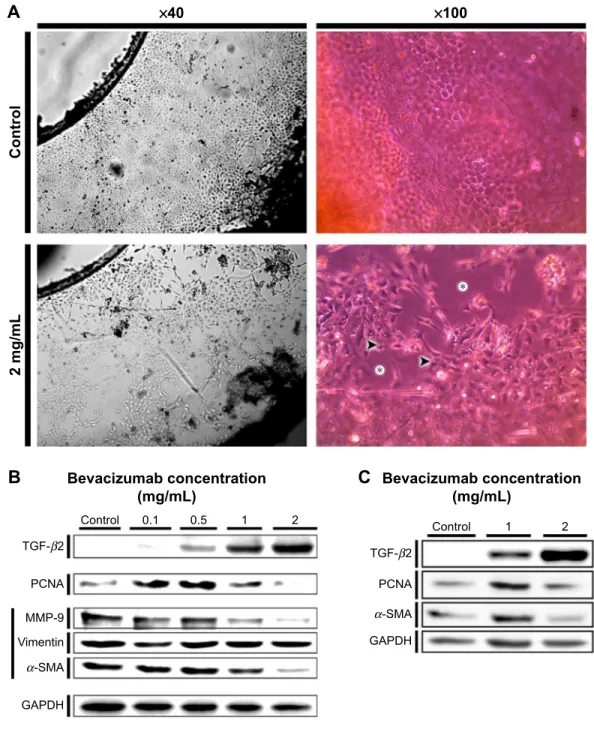 Figure 3 effects of bevacizumab on cellular morphology and expression of factors related to eMT and proliferation.