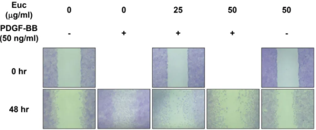 Fig.  3.  Effects  of  Euc  on  AKT  phosphorylation  in  PDGF-BB-in- PDGF-BB-in-duced  VSMCs