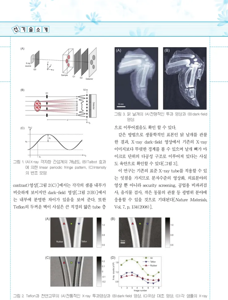 그림 3. 닭 날개의 (A)전형적인 투과 영상과 (B)dark-field 영상.