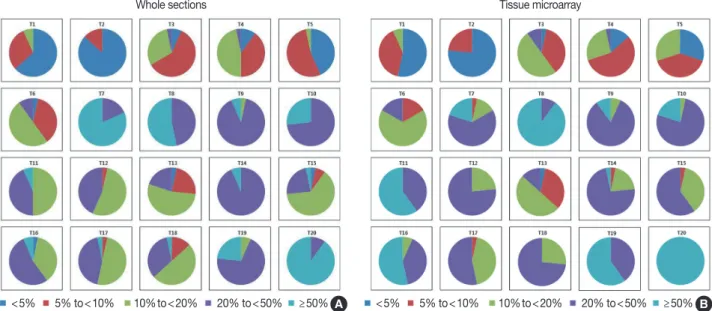 Fig. 4. Distribution of Ki-67 indices in whole sections (A) and tissue microarray slides (B) in categorical estimation