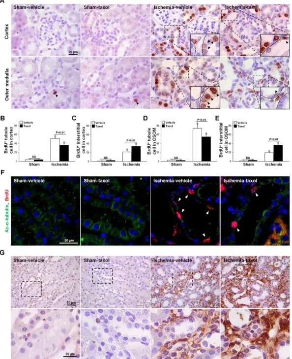 Figure 4.  Effect of paclitaxel treatment on the proliferation of tubular epithelial cells and interstitial  cells, and cell cycle arrest protein expression during the recovery phase following I/R injury