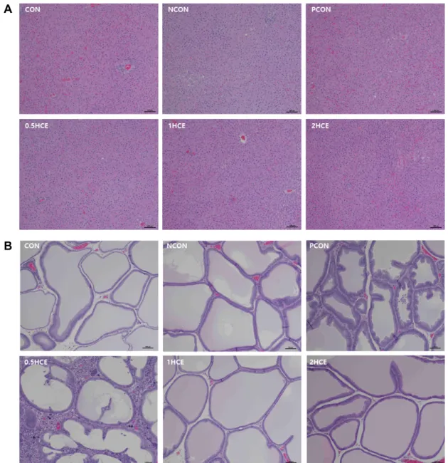 Fig.  7.  Histopathological  analysis  (H&amp;E  stains)  of  liver  (X  100)  (A)  and  prostate  (X  100)  (B)  tissue  from  the  rats