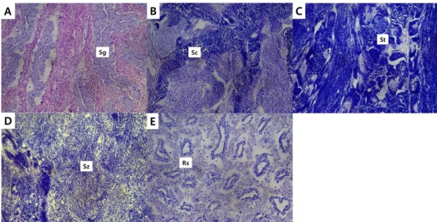 Fig  1.  Histological  observation  (X  400)  of  testis  at  different  maturation  stage  in  male  small  yellow  croaker  L