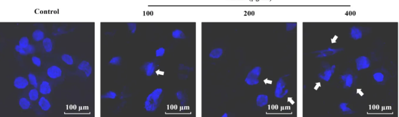 Fig.  3.  Effect  of  MMF  on  nuclear  fragmentation  in  human  prostate  cancer  LNCaP  cells