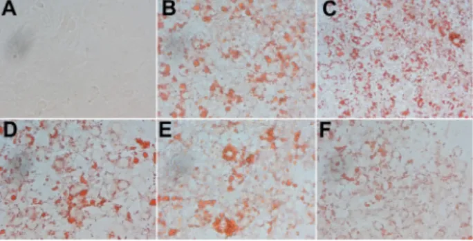 Fig.  2.  Effects  of  RYB  extracts  on  lipid  droplet  formation  in  3T3-  L1  cells