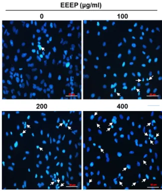 Fig.  3.  Apoptosis  induction  by  EEEP  in  A549  cells.  A549  cells  were  cultured  and  treated  with  indicated  concentrations  of  EEEP  for  48  hr