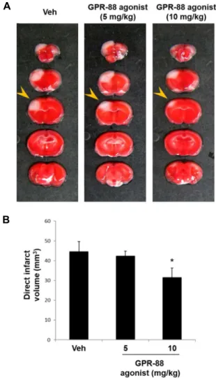 Fig.  4.  Effect  of  GPR88  agonist  on  brain  injury.  (A)  Mice  were  intraperitoneally  injected  with  the  GPR88  agonist  RTI-  13951-33  hydrochloride  (5  or  10  mg/kg,  n=5  each)  or  PBS  (vehicle  group,  n=5)  30  min  prior  to  ischemic 