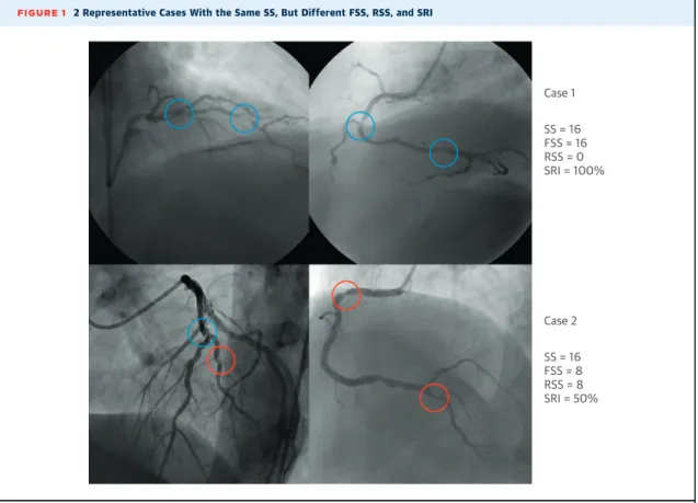 FIGURE 1 2 Representative Cases With the Same SS, But Different FSS, RSS, and SRI