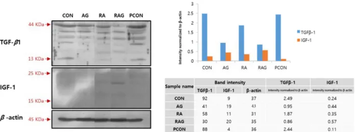Fig.  4.  Effects  of  RA,  AG  and  a  mixture  of  these  compounds  on  expression  of  IGF-1  and  TGF-β1  by  western  blot