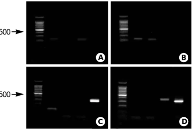 Fig. 1. PCR product patterns of S. agalactiae, S. pneumoniae, H.