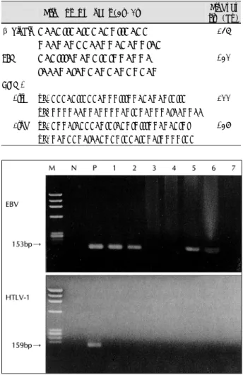 Table 1. Primer sequences for detection of  β-globin, EBV and  HTLV-1 and PCR product size (bp) 