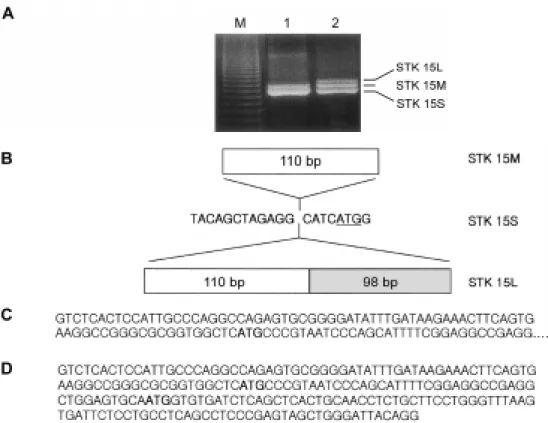 Figure 1. Alternative splicing generates three distinct mRNA transcripts. Primary tumor RNA samples and MDA 231 breast cancer RNA samples were incubated with reverse transcriptase and the resultant DNA was amplified by PCR as described under Materials and 