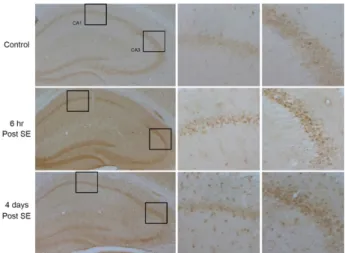 Fig.  1.  Immunohistochemistry  of  Bmi1  in  the  hippocampus. 