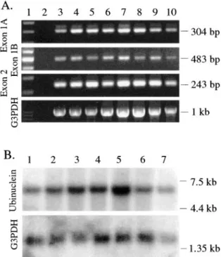 Figure 4. Expression of ubinuclein transcript in human tumor tis- tis-sues. A, Tumor tissue cDNA panel was used as a PCR template as described in Fig
