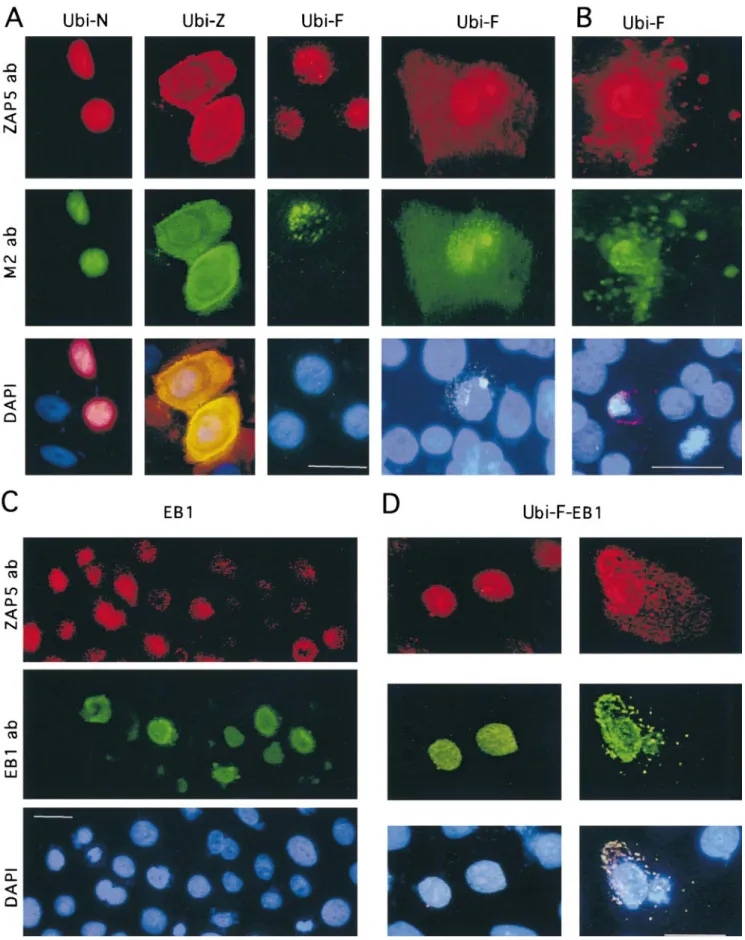 Figure 7. Expression of transiently transfected ubinuclein constructs Ubi-F, Ubi-N, and Ubi-Z/ZAP5, as well as EB1 in primary fore- fore-skin keratinocytes