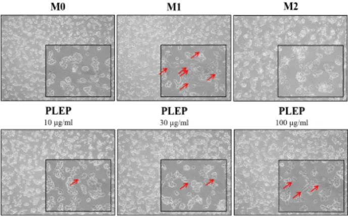 Fig.  2.  Effect  of  PLEP  on  cell  viability  of  THP-1  cells.  Cells  were  treated  with  various  concentrations  of  PLEP  for  24  and  48  hr