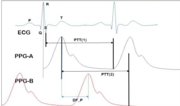 Fig.  1.  Estimation  of  diastolic  blood  pressure  using  two  PTTs ECG를 제외한 두 개의 PPG로 측정할 경우 PTT(1) 과 동일한 시간차로 추정할 수 있는 PTT는 PPG-A의 최 고 피크와 PPG-B의 최저 피크간의 PTT(2)로 대응할 수  있다[9]