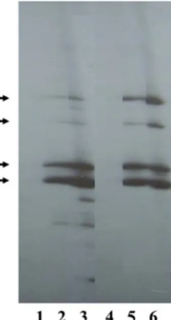 Fig.  1.  Representative  differential  display  profiles  of  RNA  sam- sam-ples  from  Pseudomonas  sp