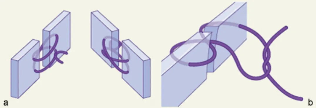 Fig. 4 (a) Concept of authors’ vertical ﬁgure-of-eight locking suture. (b) The ﬁgure-of-eight locking suture of Byrd et al