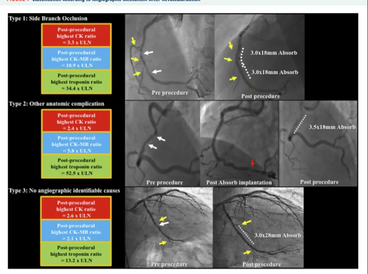 FIGURE 1 Classiﬁcation According to Angiographic Mechanism After Revascularization