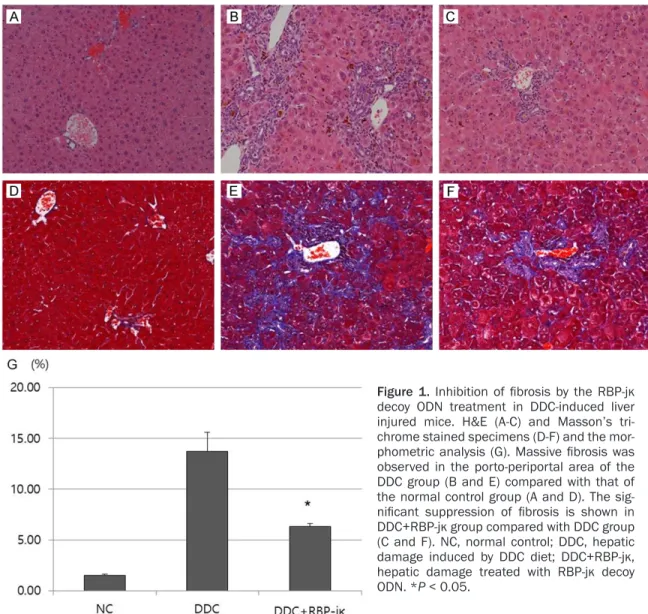 Figure 1.  Inhibition  of  fibrosis  by  the  RBP-jκ  decoy ODN treatment in DDC-induced liver  injured  mice