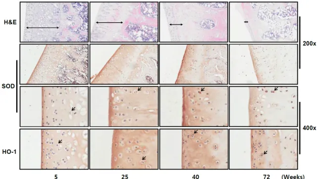 Fig.  6.  Detection  of  SOD  expression  during  aging  in  rat  articular  cartilages