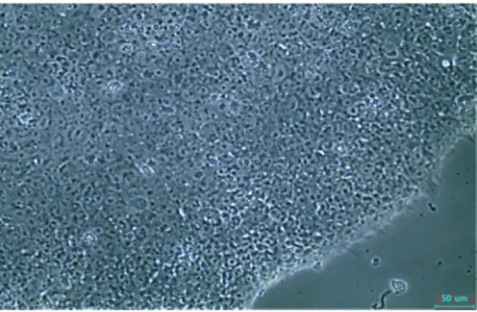 Fig.  1.  iPSCs  colony  produced  by  Episomal  plasmid. 덩어리를 분리하였고,  이를 1:4의 비율로 분할하여 Geltrex ™ 로  코팅된 새 배양접시에서 계대배양을 하였다