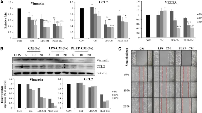 Fig.  5.  Conditioned  media  of  RAW  264.7  cells  represses  migration,  invasion  and  angiogenesis  ability  in  PC-3  cells