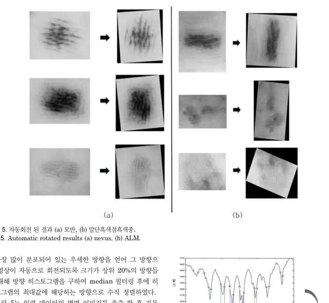 그림 6. 라인 추출 후 가우시안 미분하여 얻은 경계선 그래프.
